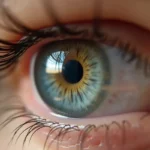 Zaćma wtórna ICD-10 – Objawy, Diagnostyka i Leczenie